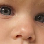 Bebekte Göz Kayması Neden Olur?