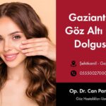 Light Padding Under The Eyes Of Gaziantep
