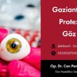 Gaziantep Prosthetic Eye